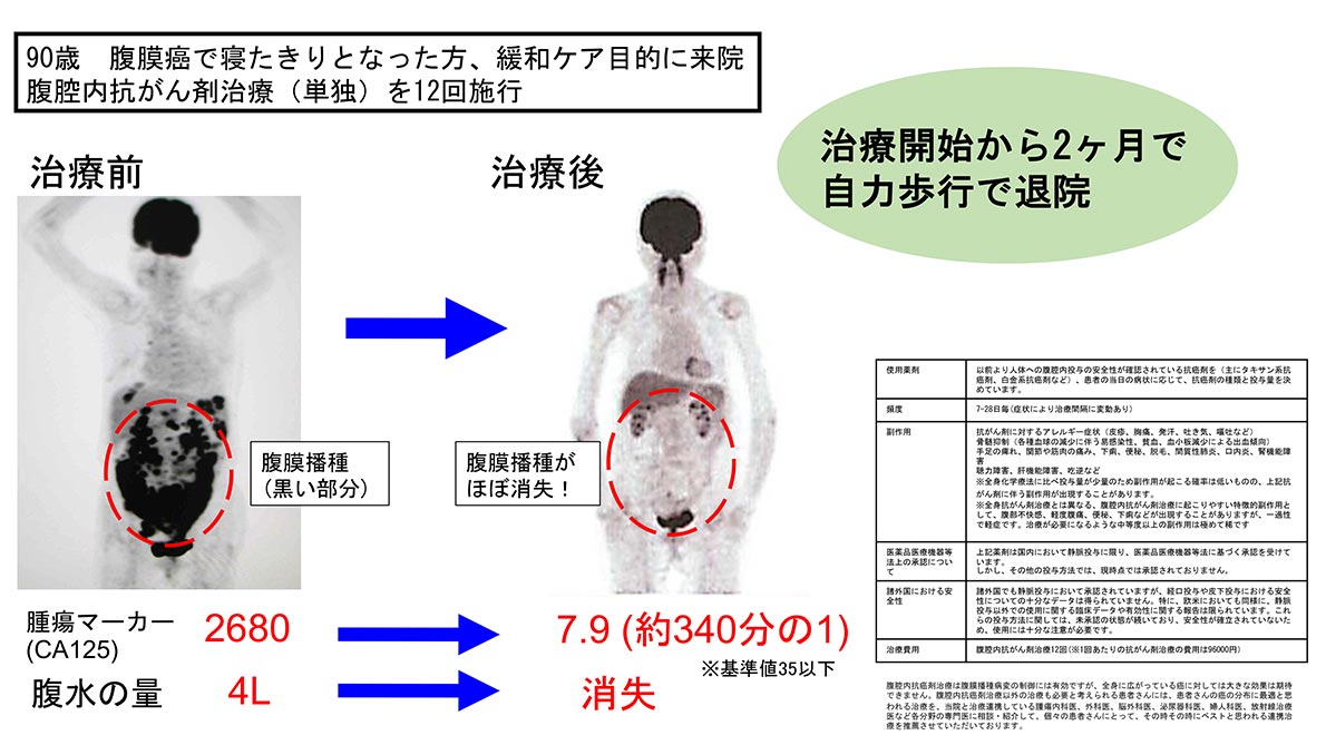 まずは実際の症例をご覧ください